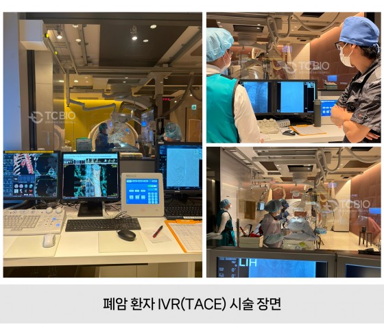 [월간암] 설암, 췌장암 중입자치료를 할 수 없을 때, IVR 등 4종복…